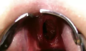 fisting anal ganda,  ...