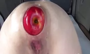 anal fisting ekstrim ...